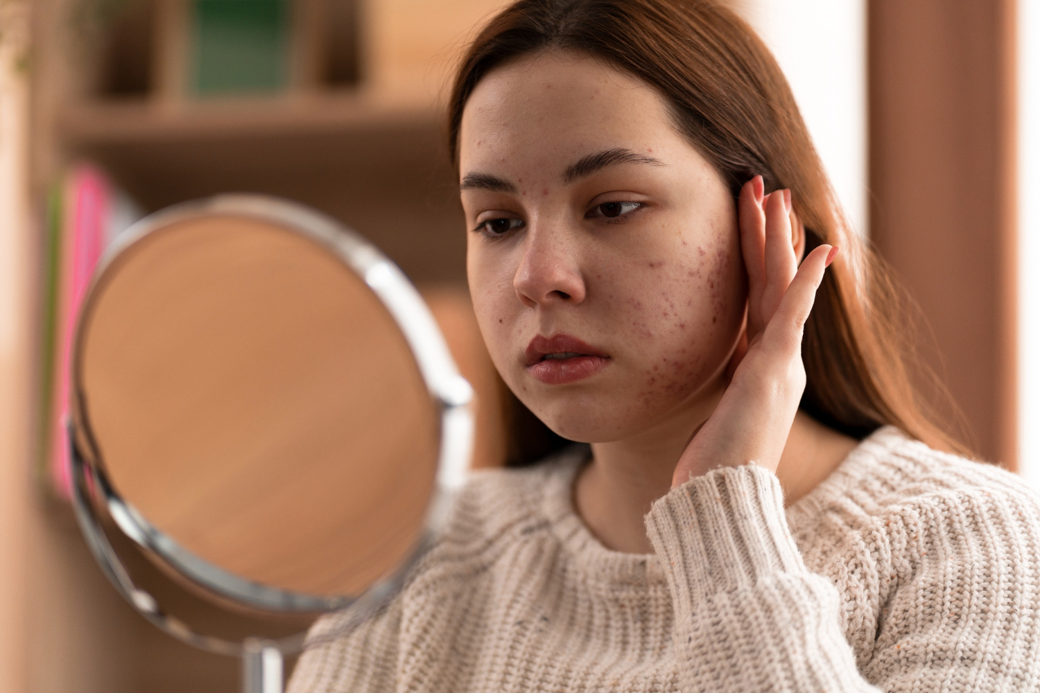 acne-pimples