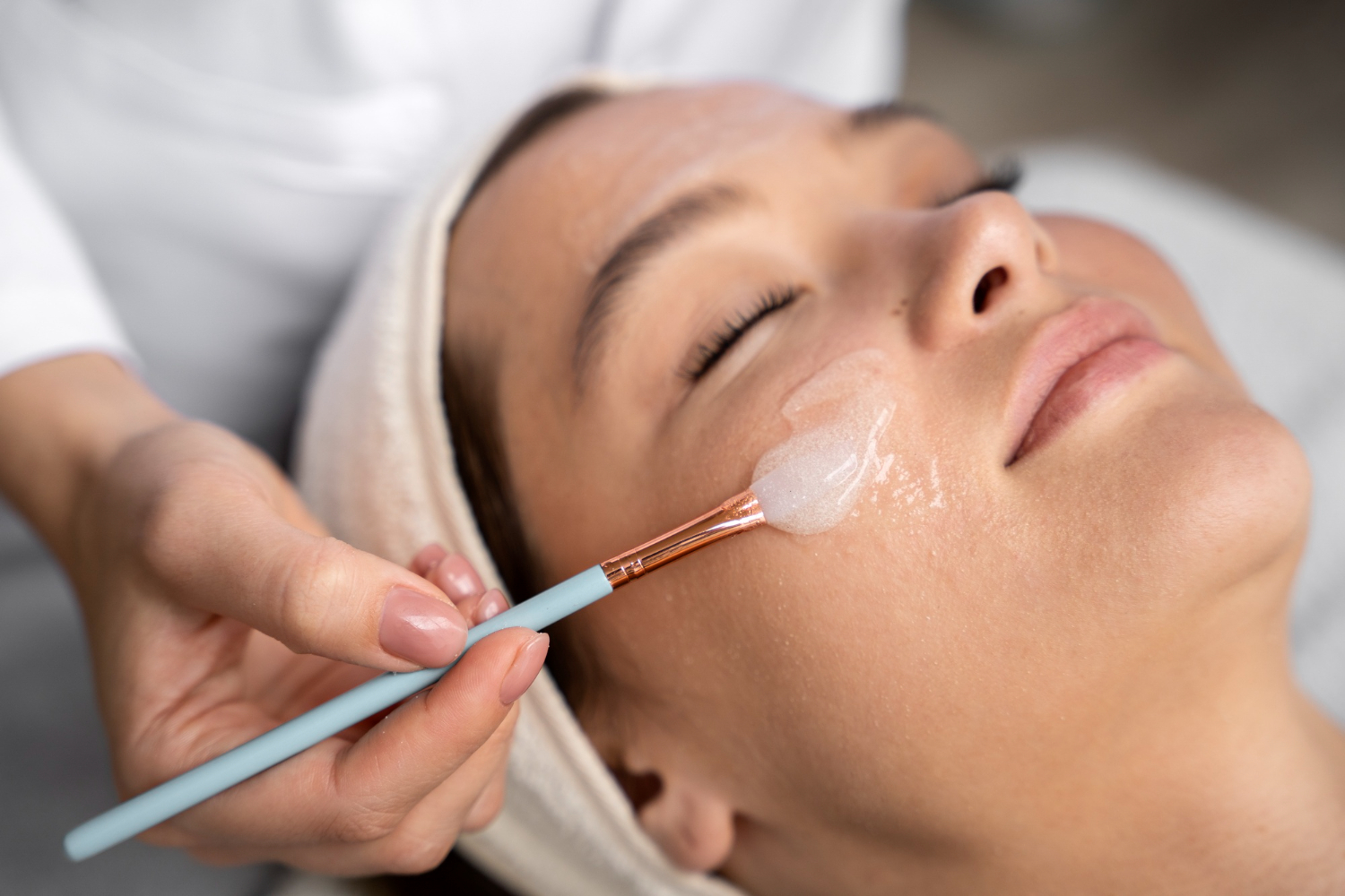 chemical-peel