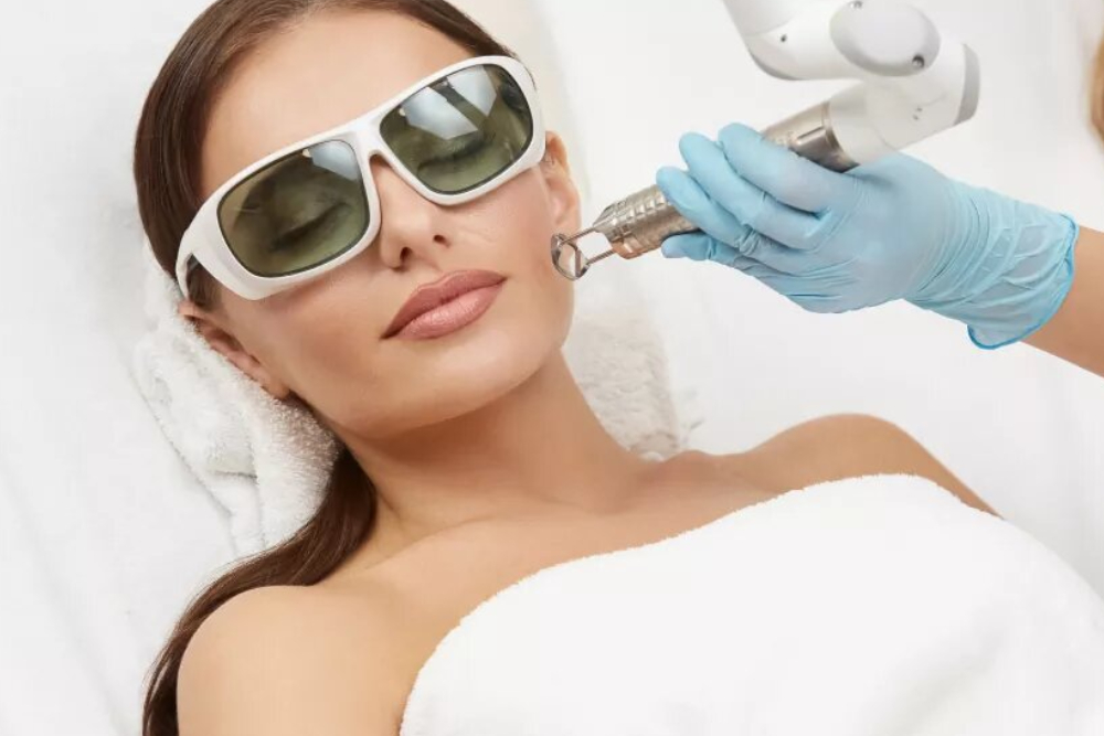 Fractional CO2 Laser is one of the most advanced skin resurfacing treatments offered by Dr. Mallika Demmbla. It helps reduce fine lines, wrinkles, scars, and uneven skin texture by stimulating natural collagen production. This minimally invasive procedure delivers precise results with faster healing compared to traditional resurfacing. Patients often notice smoother, younger-looking skin after just a few sessions. It is a safe and effective option for long-lasting skin rejuvenation.