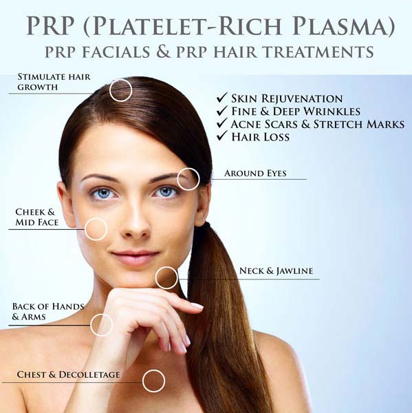 Prp