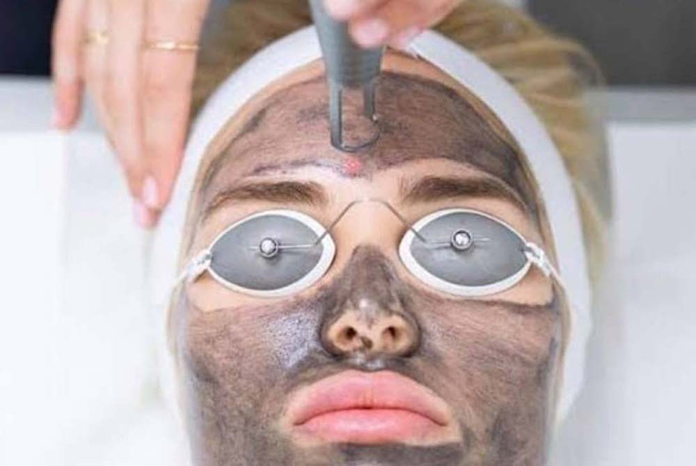carbon-peel-header