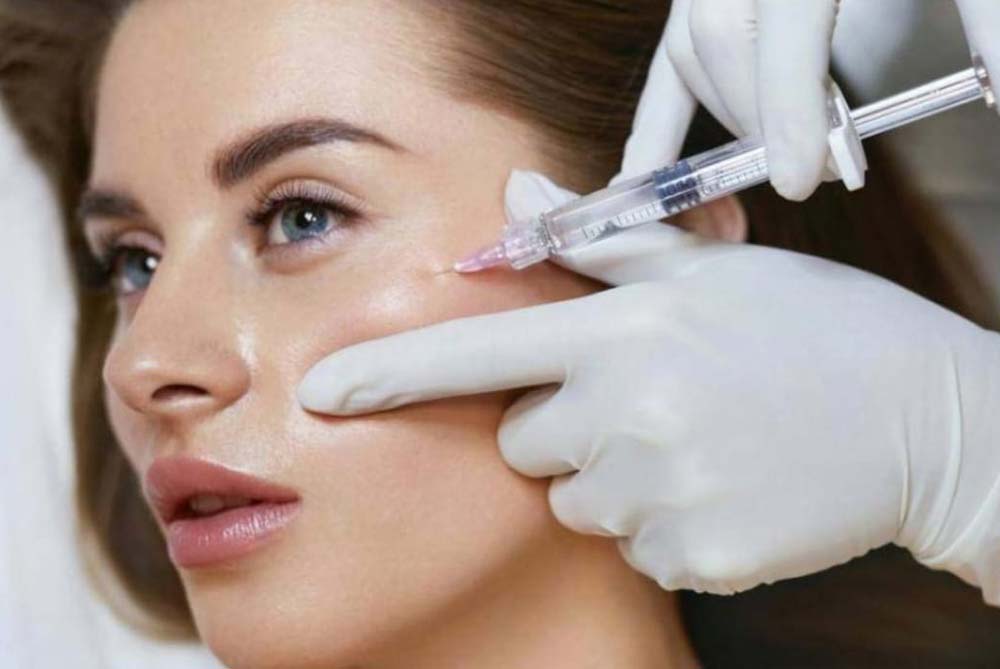 dermal-filler