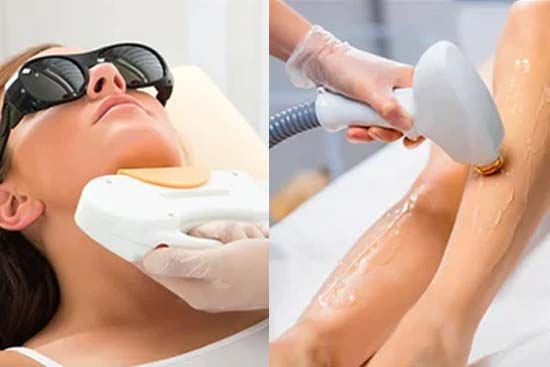 Laser Hair Reduction