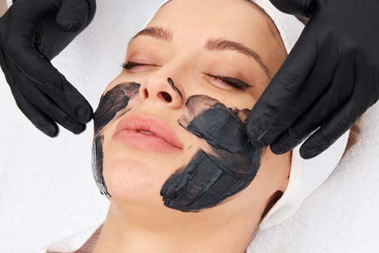 Laser Peel / Carbon Peel