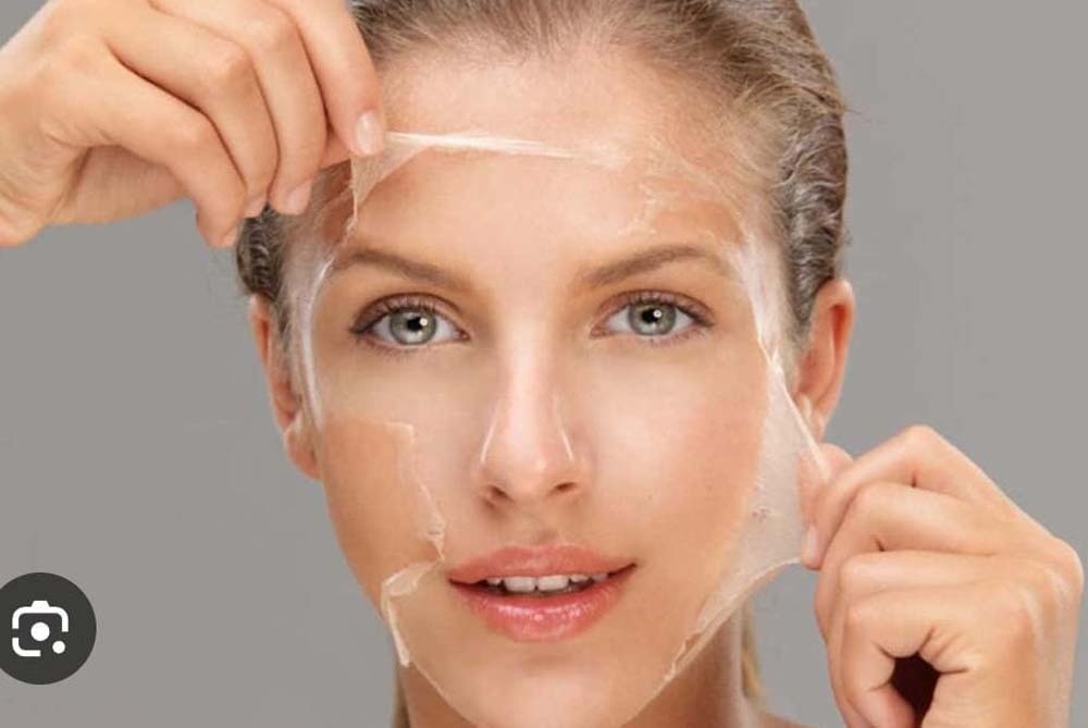 skin-peels